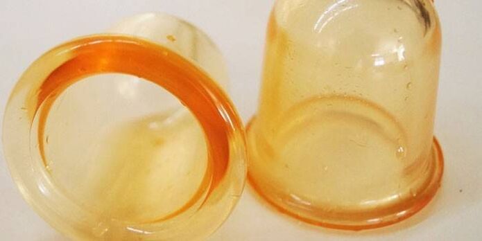 tazas para el tratamiento de la prostatitis